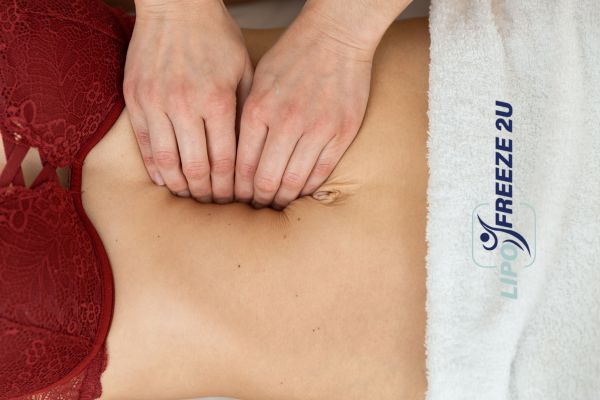diastasis recti treatment Norfolk