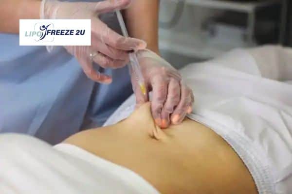 Fat Dissolving Injections Norfolk & Weight loss medication