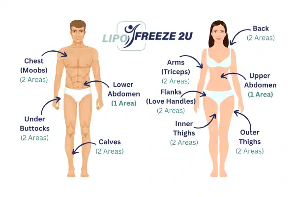 Areas you can have fat freezing treatment Norfolk