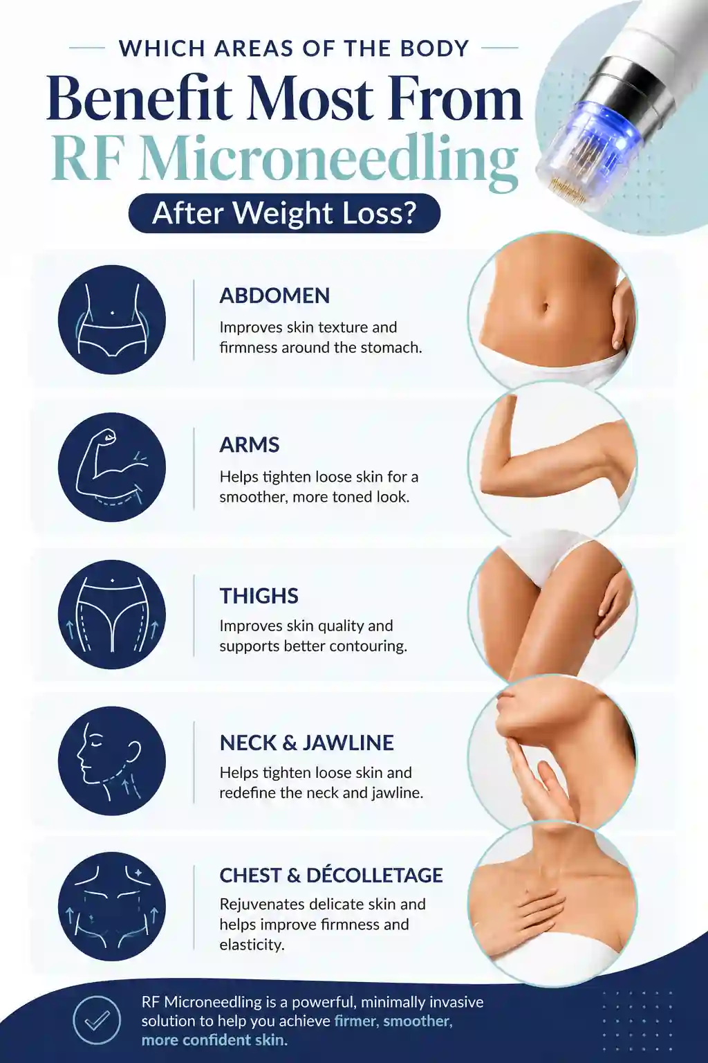 Which Areas of the Body Benefit Most From RF Microneedling After Weight Loss Norfolk